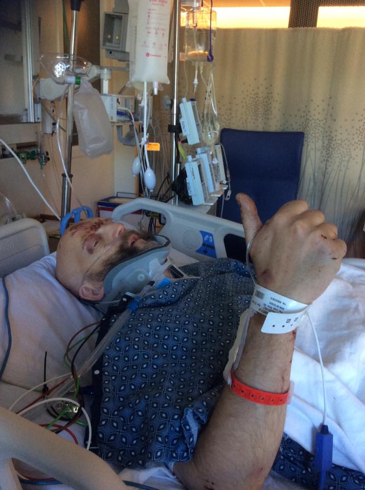 Jim Tavarè, il Tom di “Harry Potter”, grave dopo un incidente d’auto