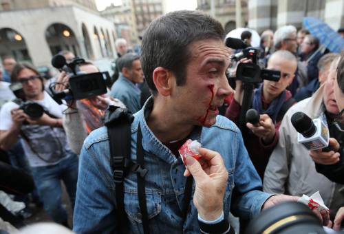 "Mi hanno colpito alle spalle potevo perdere un occhio"