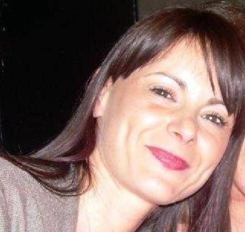 Sfigurata con l'acido Chiede all'ex danni per 10 milioni