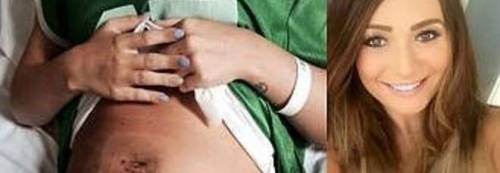 Va in vacanza in un resort in Egitto, quando torna rischia di morire