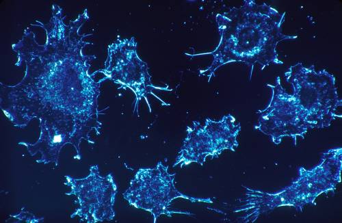 Tumori, la scoperta italiana: trovate le "cellule disertori"