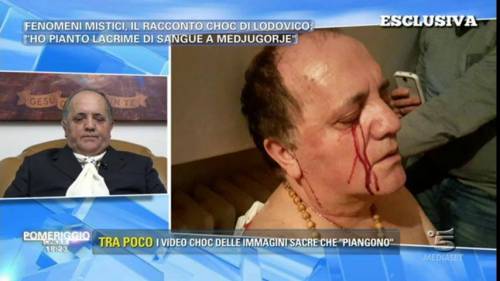 Pomeriggio 5, ex malato terminale piange lacrime di sangue
