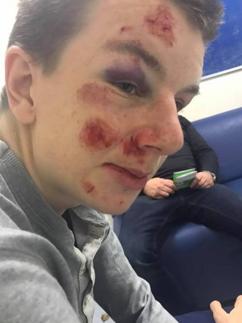 Ragazzo autistico pestato dai bulli per cinque sterline