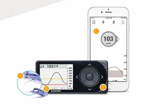 Un sistema che migliora la vita dei diabetici