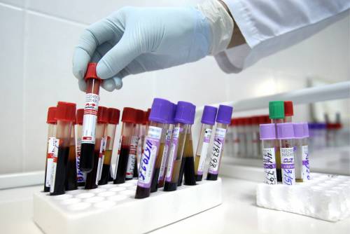 A processo il sieropositivo che infettò decine di donne a Roma