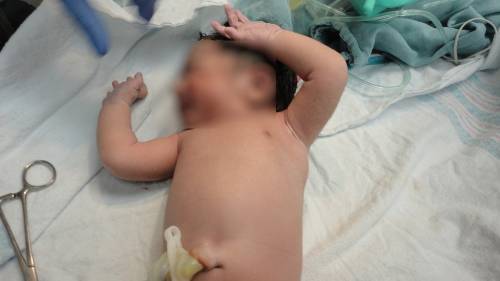 Caserta, partorisce in auto davanti al marito e ai tre figli