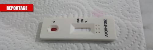 "Ci basta una goccia di sangue": così il test rapido trova il virus