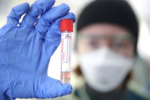 Ecco i test di massa sugli anticorpi: si scoprirà chi ha avuto il virus