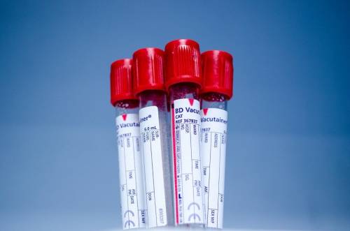 Coronavirus, un nuovo test del sangue in gravidanza