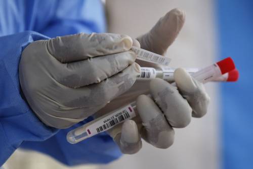 Tra 8 giorni scattano gli esami sugli anticorpi. Ma per gli imprenditori sarà già troppo tardi