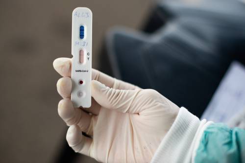 Quanto sopravvive il coronavirus: "A 22 gradi resiste sette giorni"