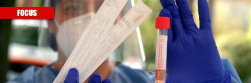 Ritardi e pochi tamponi nel Lazio, ecco la verità
