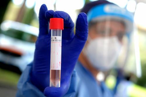 Virus, un contagio ogni 30 tamponi
