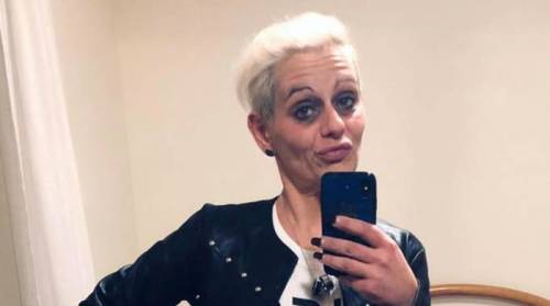 Stalkerizzato e sfregiato con l'acido ma per i giudici non c'è premeditazione
