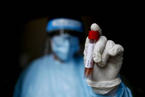 Coronavirus, studio conferma: "Ci si può contagiare più volte"