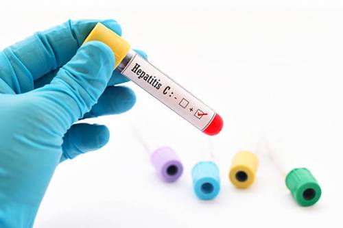 Contagio, sintomi e diffusione: ecco perché l'epatite C fa paura