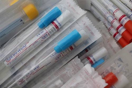 La truffa sui tamponi elaborati coi macchinari che cercano virus animali