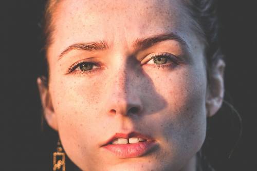 Psoriasi, che cos'è e come si cura