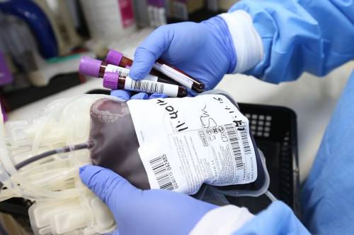Tumori del sangue, scoperti nuovi potenziali precursori
