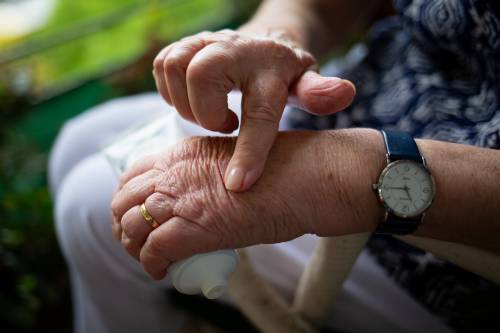 Artrite reumatoide: insorgenza, sintomi e rimedi