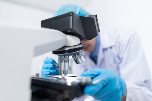 Immunoterapie, così riducono la progressione del melanoma del 25%