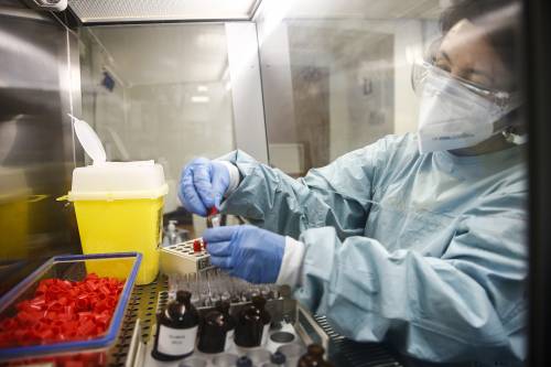 Super anticorpi usati come terapia: la nuova scommessa per vincere il virus Super anticorpi usati come terapia: la nuova scommessa per vincere il virus