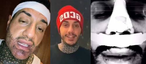 Ennesimo ritocchino per Francesco Chiofalo. Il web lo batosta: "Ma che problemi hai?" Ennesimo ritocchino per Francesco Chiofalo. Il web lo batosta: "Ma che problemi hai?"