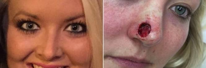 Ho Paura Di Avere Un Tumore Alla Lingua
