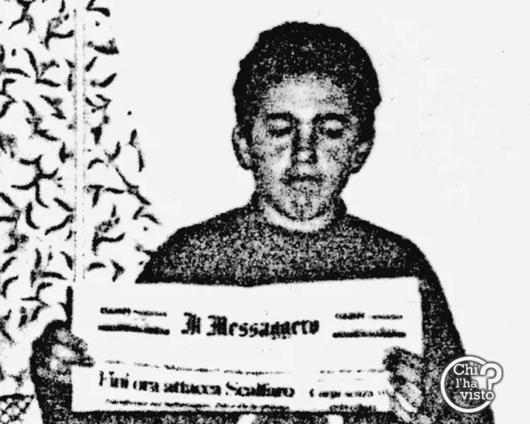 Le curano i capelli, costretta al trapianto di fegato