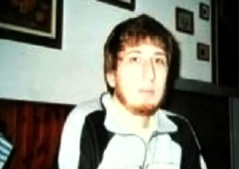 Morte dopo la rinoplastica 
Gli organi saranno espiantati