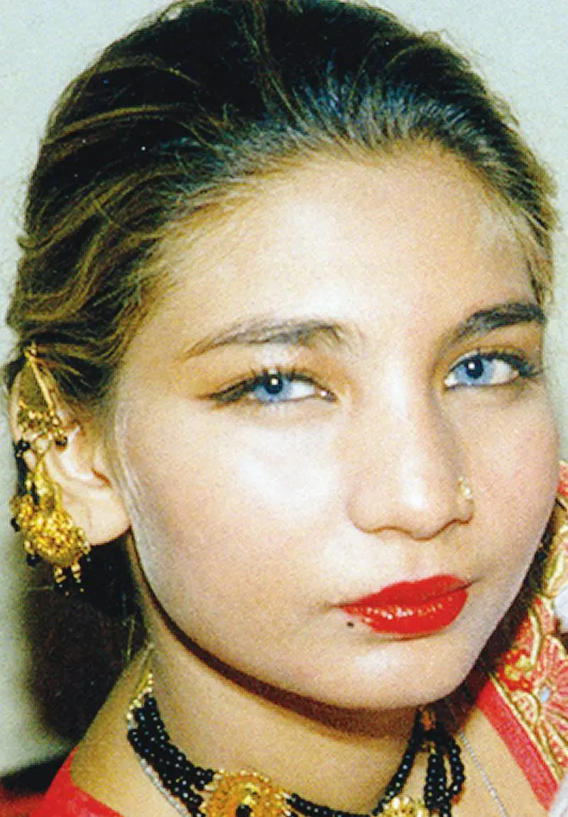 Trento, sfigurata con l’acido 
dal marito marocchino