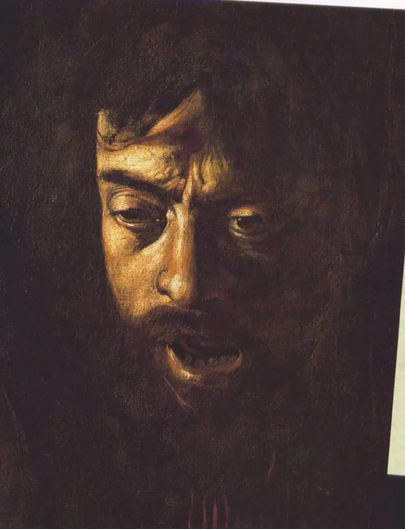 Caravaggio morì per la sifilide