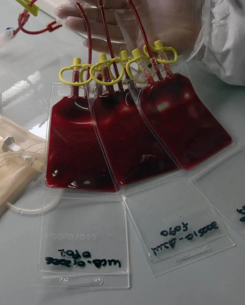 Prelievi di sangue inutili per gonfiare i rimborsi Perquisito il San Gerardo