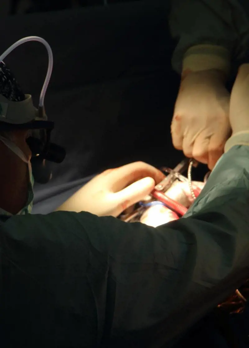 Una nuova tecnica chirurgica per riparare la valvola aortica