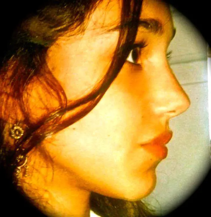Immagine gallery