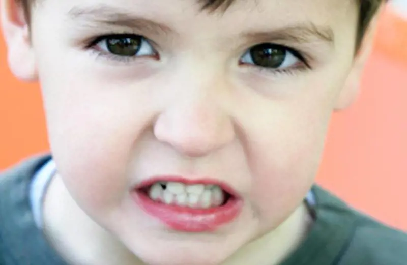 Un rimedio «meccanico» per chi digrigna i denti