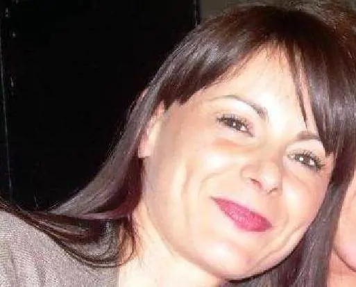 La vendetta dell'ex: sfigurata col vetriolo