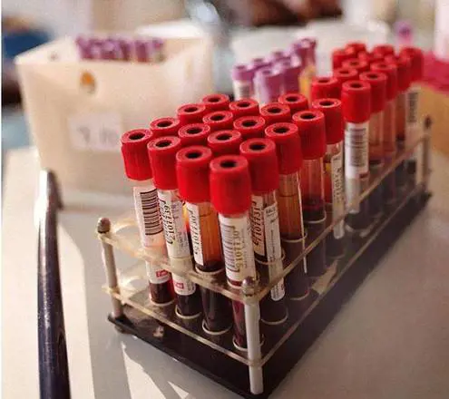 Assenteisti per donare sangue, Avis: "Isolare i furbacchioni"