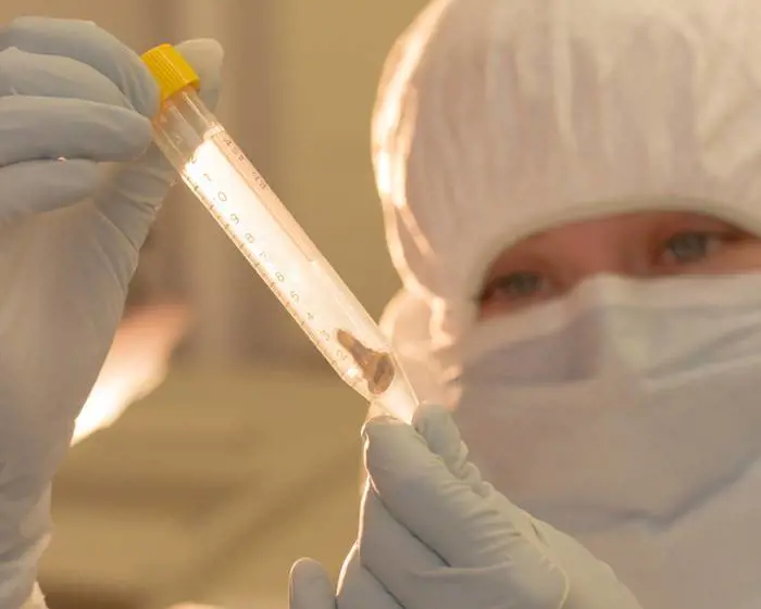 Torna l'influenza suina, morta una donna in Veneto