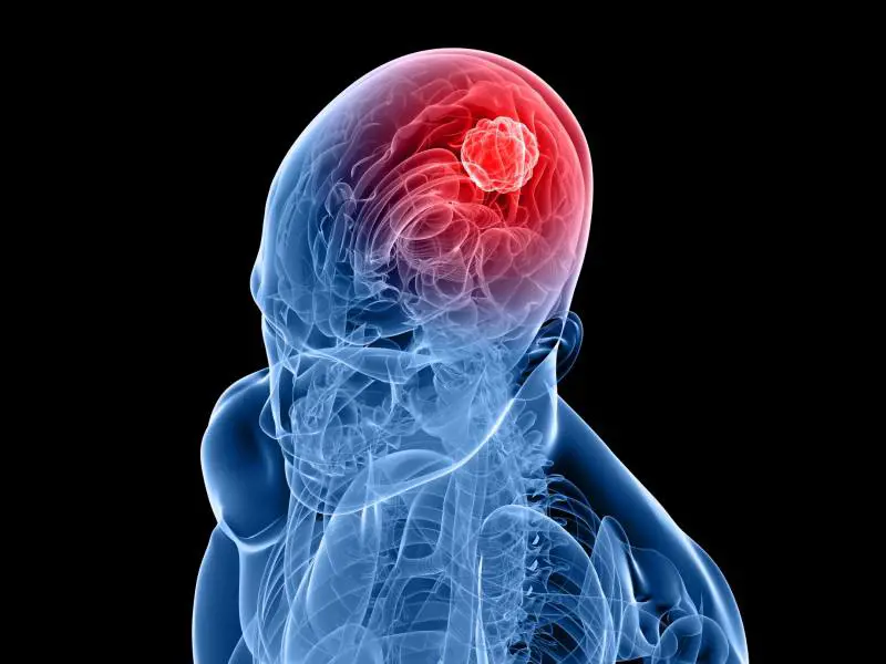 Ha mal di testa, i medici: "Hai ancora trenta minuti di vita"