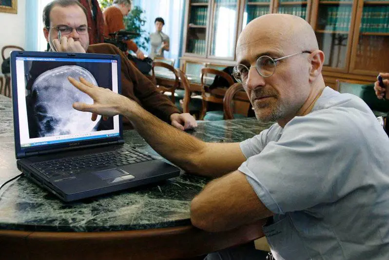 Trapianto di testa? "Possibile entro il 2017"