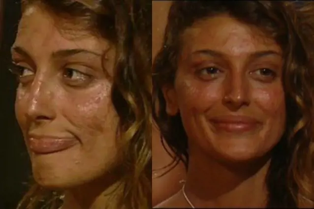 Cristina Buccino devastata dai mosquitoes