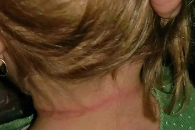 Australia, bimba rischia di morire strangolata dai capelli della sorellina