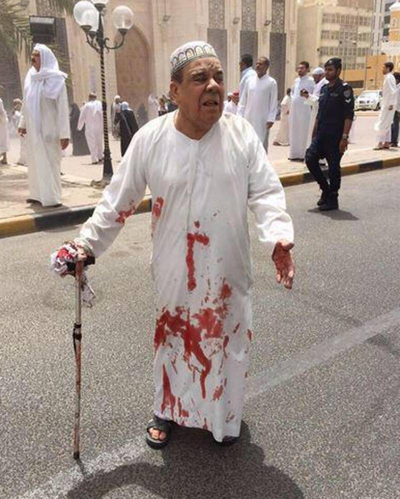 Un uomo con la dishdasha imbrattata di sangue dopo l'esplosione