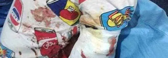 Cina, tigre strappa il braccio a un bambino di due anni allo zoo