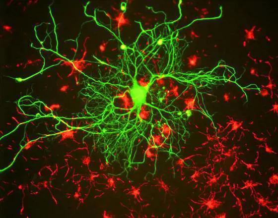 Scoperto il gene che sconfigge il parkinson