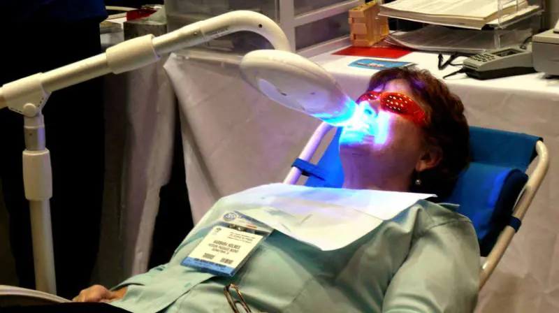 Fa lo sbiancamento dentale e perde quattro denti