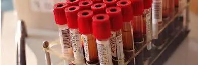 Un'analisi del sangue per individuare cinque tipi di tumore