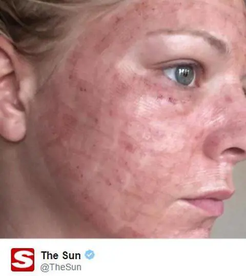 Foto tratta da The Sun