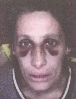 Padova, raffica di pugni in faccia: immigrato picchia donna